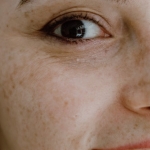 Turk-Telekom8217dan-Kas-Hastalari-Icin-Devrim-Niteliginde-Yazilim-EyeMo-featured