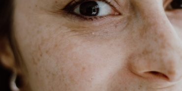 Turk-Telekom8217dan-Kas-Hastalari-Icin-Devrim-Niteliginde-Yazilim-EyeMo-featured