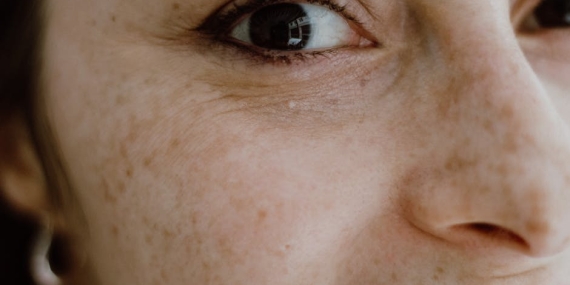 Turk-Telekom8217dan-Kas-Hastalari-Icin-Devrim-Niteliginde-Yazilim-EyeMo-featured